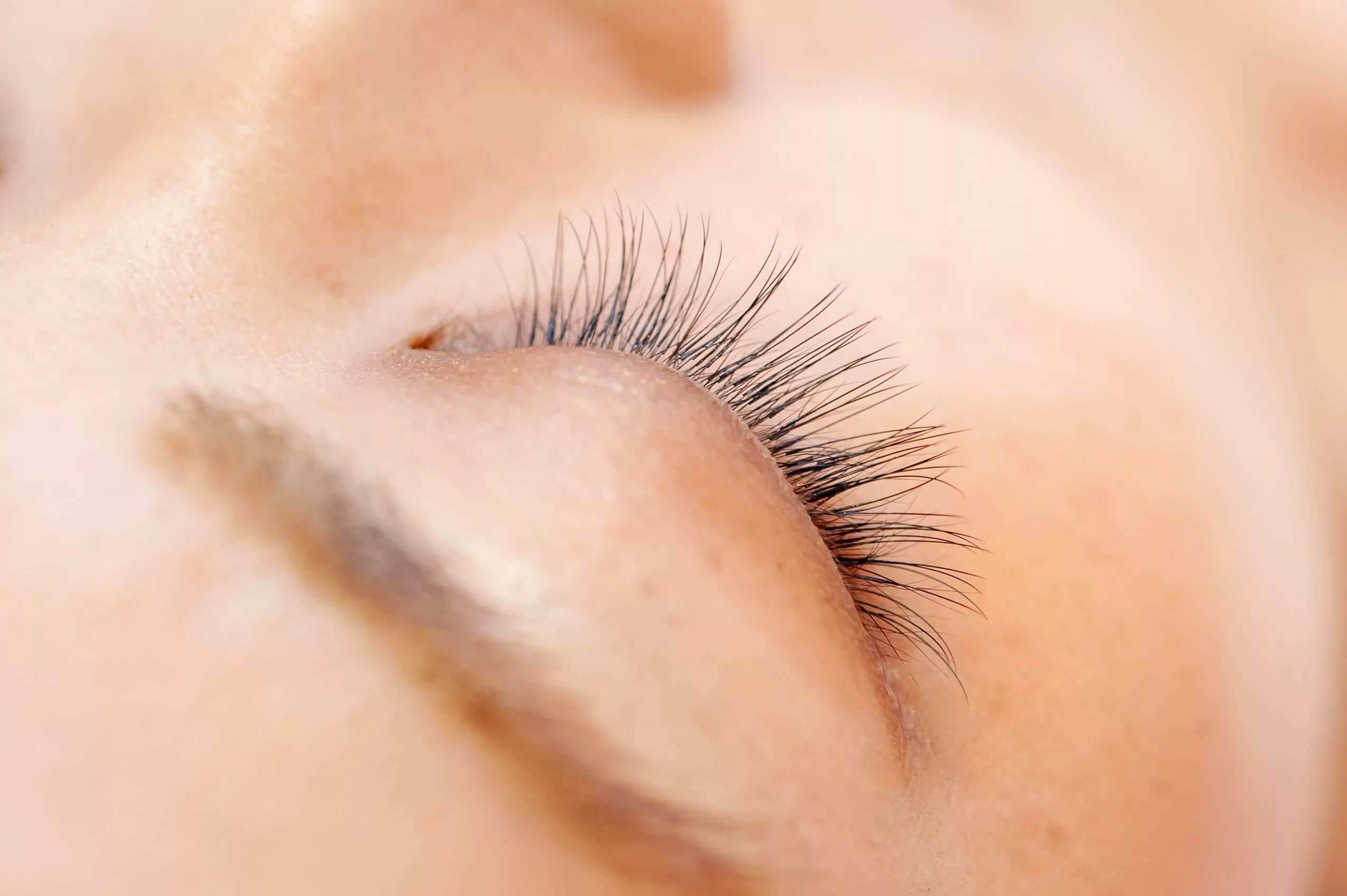 Chirurgie paupières spécialiste - Dr Sabatier - Chirurgien esthétique à Nice